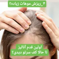 پاکسازی کف سر،درمان ریزش،شوره چربی سروضخیم سازی مو|خدمات آرایشگری و زیبایی|نیشابور, هفده شهریور|دیوار