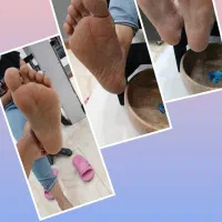 کفسابی و کاشت مژه