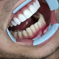 جذب دکتر دندانپزشک