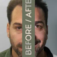 کاشتمو و ابرو|خدمات آرایشگری و زیبایی|تهران, جردن|دیوار