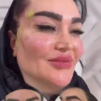 پزشک متخصص ژل و بوتاکس لیفت بانخ افزایش سایزآلت|خدمات آرایشگری و زیبایی|قم, صفائیه|دیوار