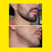 پرپشت جذاب بی‌نقص مثل یک ستاره