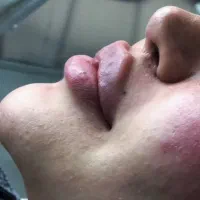 معجزه زیبایی دراسلام آبادغرب