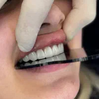 خاصترین کامپوزیت بیا ساری  فقط ۱۹۹۰۰ هرفک تا۴۸ساعت