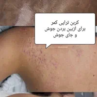 آلگاپیل،فیشال (خانمها و آقایان)|خدمات آرایشگری و زیبایی|یاسوج, |دیوار