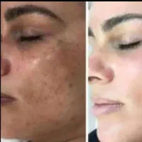 کرم سفیدکننده امارات وفرمول آن