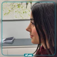 جشنواره عمل بینی/جراحی بینی نقد و اقساط