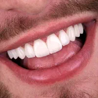 دندانپزشکی زیبایی و درمان با تخفیف ویژه افتتاحیه