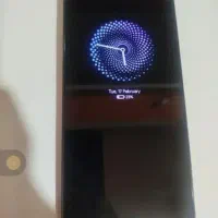 گوشی شیائومی نوت 13