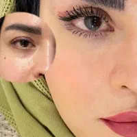 انجام اعمال جراحی زیبایی توسط جراح متخصص