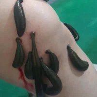 انواع حجامت ، زالو درمانی ، بادکش|خدمات آرایشگری و زیبایی|پرند, فاز ۵|دیوار