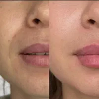 خدمات زیبائی|خدمات آرایشگری و زیبایی|فاضل آباد, |دیوار