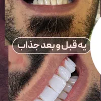 جشنواره کامپوزیت از ۵۹۰|خدمات آرایشگری و زیبایی|اهواز, کیانپارس |دیوار
