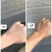 روشن شدن صورت و بدن تضمینی|آرایشی، بهداشتی، درمانی|پارسآباد, |دیوار