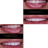 خدمات کامل دندانپزشکی/مشاوره رایگان/طراحی لبخند