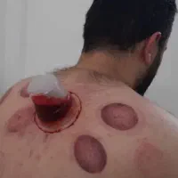 حجامت درمنزل