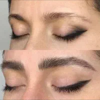 آموزش فیبروز صفر تا صد با همراهی بی نهایت