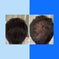جدید ترین متد دنیا