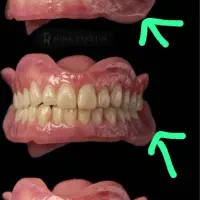 به یک خانم مبتدی جهت دندانسازی نیازمندیم