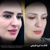 عمل بینی/ کاشت ابرو و مو / بلفارو /تزریق چربی|خدمات آرایشگری و زیبایی|قم, نوبهار|دیوار