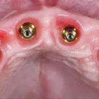 اوردنچر دوفک فقط ۱۰۰ تومن در تبریز|خدمات آرایشگری و زیبایی|مشگین شهر, |دیوار