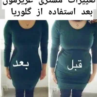 درمان چاقی