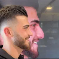 لیفت صورت ،شقیقه،گونه ،جراحی بینی ،تخفیف تابستان|خدمات زیبایی و سلامت|تهران, ونک|دیوار