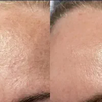 آموزش فشیال دوره پایه و تخصصی با دستیاری و استخدام|استخدام درمانی، زیبایی، بهداشتی|تهران, صادقیه|دیوار