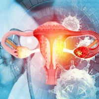 بهبود بیماری های بانوان(گیاهی)