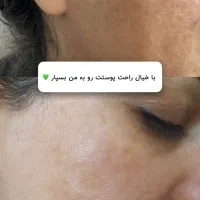 ریمولک تک جلسه ایی