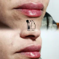 تزریق ژل و بوتاکس|خدمات آرایشگری و زیبایی|جهرم, |دیوار