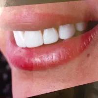 دستیار دندانپزشک