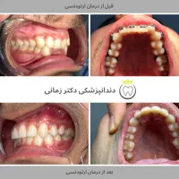 ارتودنسی ثابت و نامرئی (دیجیتال) با شرایط اقساط|خدمات زیبایی و سلامت|تهران, امیریه|دیوار