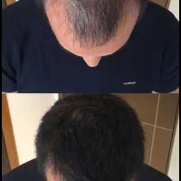 گیسو شو