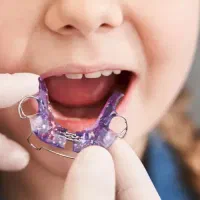 ارتودنسی اقتصادی ویژه زیر ۱۲ سال