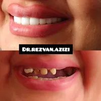 دیگر نگران هزینه‌های سنگین خدمات دندانپزشکی نباشید|خدمات آرایشگری و زیبایی|شیراز, ملاصدرا|دیوار