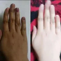 فرمول سفیدکننده