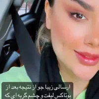 تزریق ژل و بوتاکس