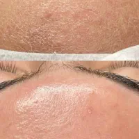 پاکسازی پوست با تخفیف ویژه|خدمات آرایشگری و زیبایی|رشت, استقامت ۱|دیوار
