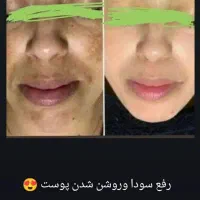 مشاور سلامت و درمانگر پاکسازی