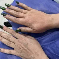 تزریق ژل وبوتاکس تزریق چربی صورت وباسن|خدمات زیبایی و سلامت|تهران, شهرک فردوس (حسینی)|دیوار