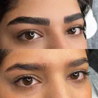 میکروبلیدینگ ۶۵۰