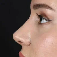 عمل جراحی زیبایی بینی،صورت،پلک،لیپو ابدو|خدمات زیبایی و سلامت|تهران, نازیآباد|دیوار