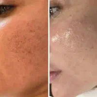 تخفیف فشیال به مدت یک هفته