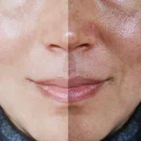 کرم روشن کننده، ضد لک، ضد جوش قوی