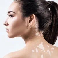 بصورت ریشه ای درمان و(یتلیگو پیسی)