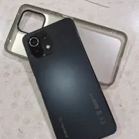 شیامی لایت 11 5G ne