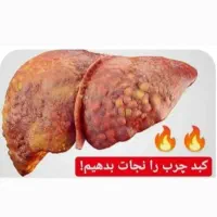 کبد چرب