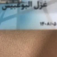 کیف پول ناحیه روبه رو لیزر خاطره پیدا شده