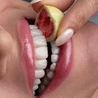 کامپوزیت دندان دندانپزشکی لمینت روکش ایمپلنت|خدمات آرایشگری و زیبایی|تهران, فردوس|دیوار